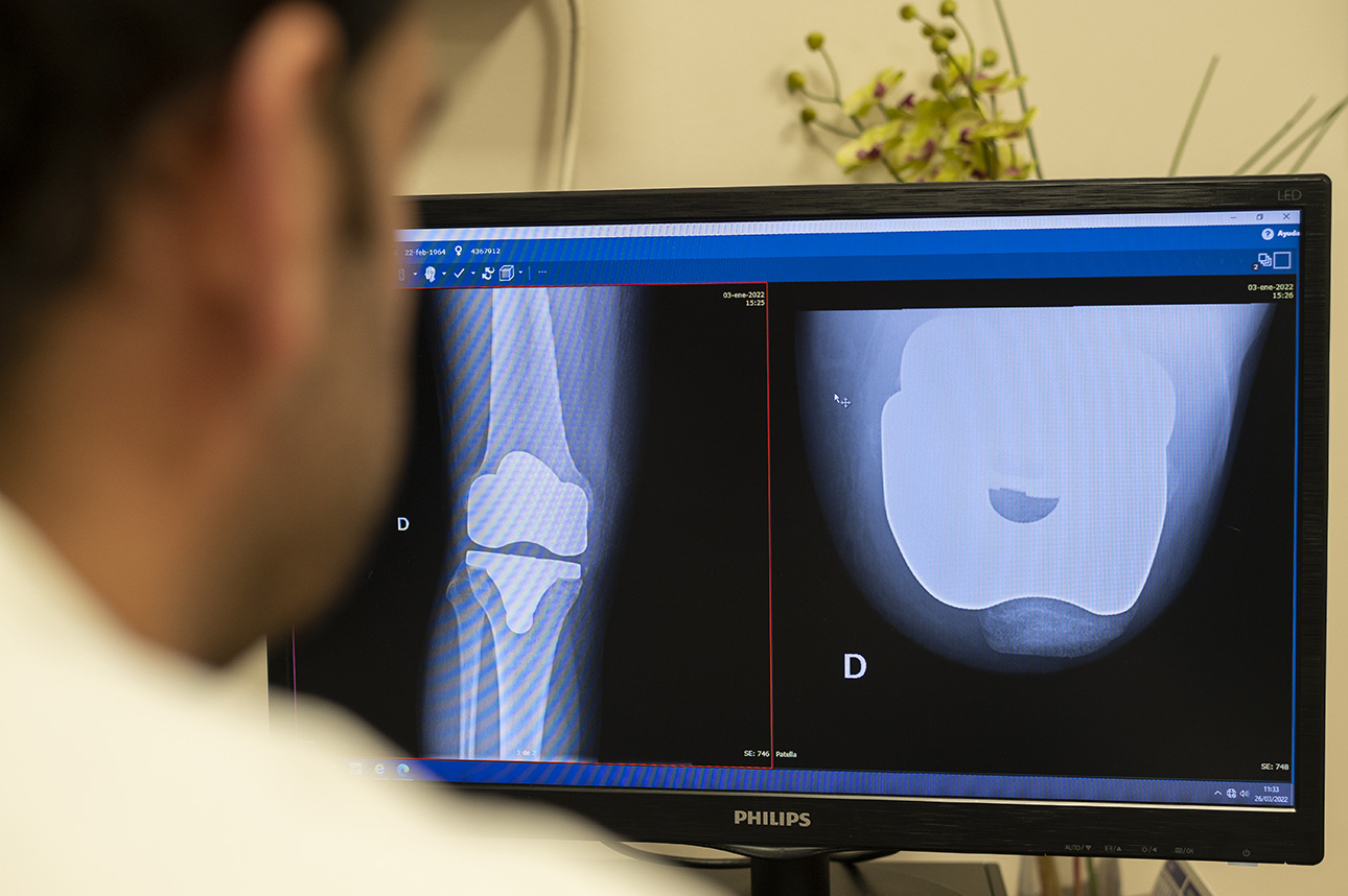 Clinica Traumatologia Galicia 5